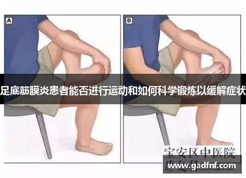 足底筋膜炎患者能否进行运动和如何科学锻炼以缓解症状